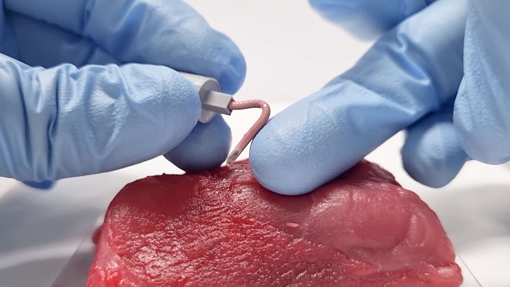 تخاف من الحقن؟ هذه الإبرة الوريدية المرنة قد تغير رأيك