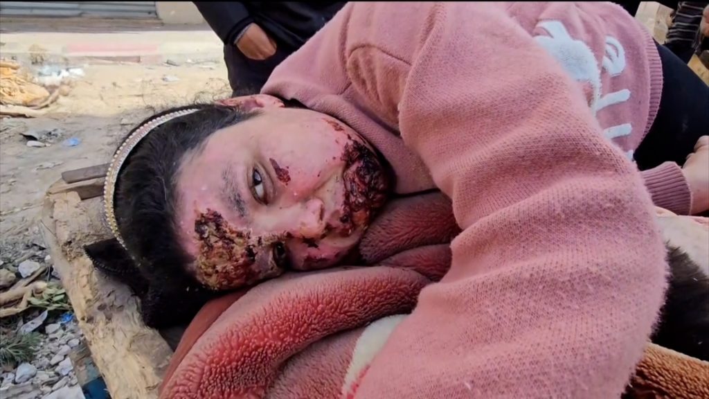 الصحة العالمية: تدمير مستشفى كمال عدوان في غزة مفزع