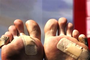 متلازمة القدم السكرية تهدد ببتر القدم