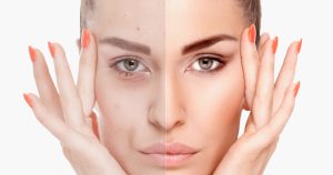 جفاف البشرة قد يرجع إلى نقص هذه الفيتامينات