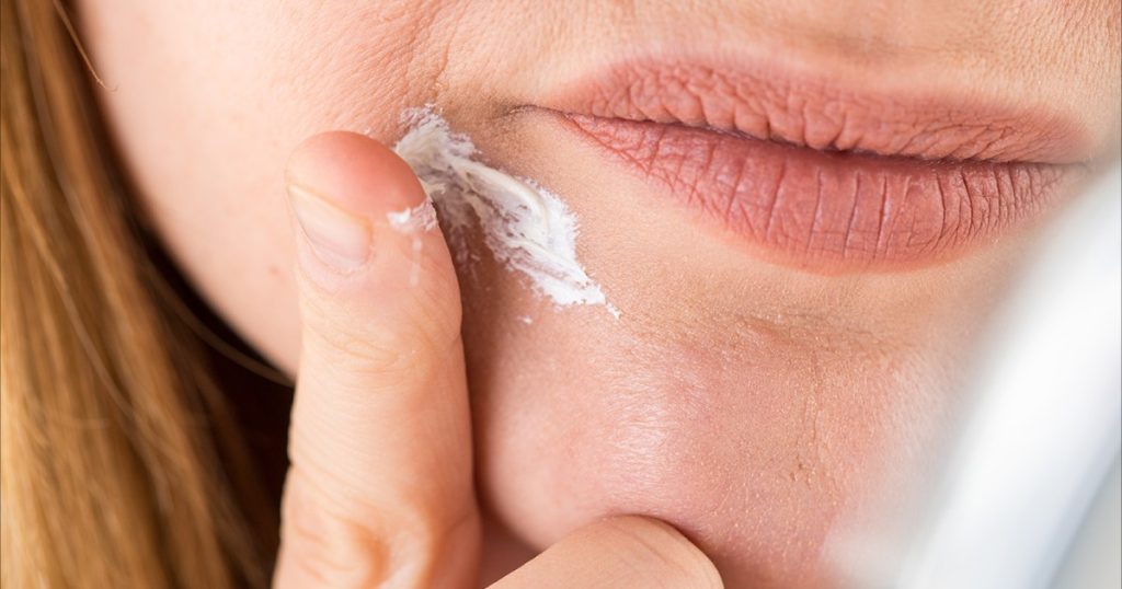 تشقق زوايا الفم قد ينجم عن أسباب خطيرة