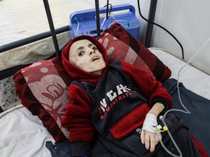 يزن الكفارنة أحدهم.. الموت جوعا يحصد أرواح 16 طفلا في غزة ويتربص بآخرين