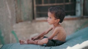 11 شهيدا جراء التجويع بغزة خلال 24 ساعة وتحذيرات من “مقتلة جماعية” للأطفال | أخبار