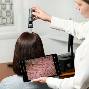 أهمية فحص فروة الرأس عند مشاكل الشعر – أخبار السعودية