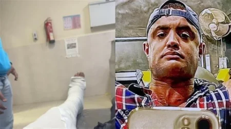 9 مسامير وشريحة لإنقاذ بطل كمال الأجسام في مسلسل «الكينج» – أخبار السعودية