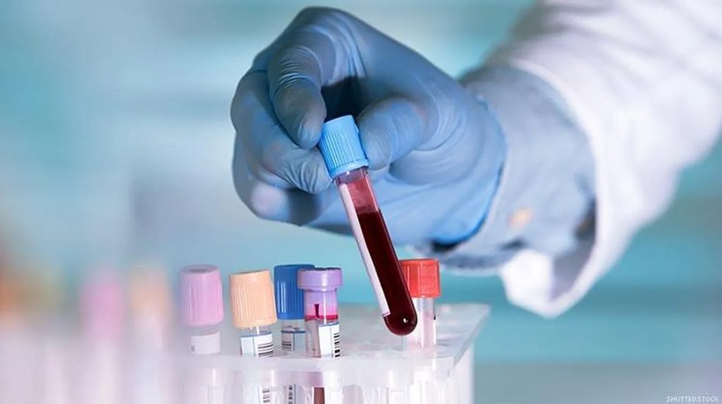 هيئة الصحة العامة: فحص ما قبل الزواج خطوة بسيطة تحمي أسرتك ومستقبل أبنائك