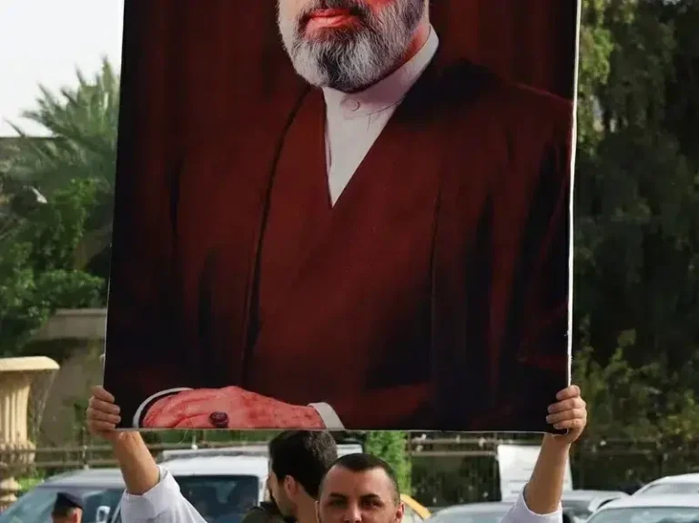 تفاصيل جديدة حول صحة مرشد إيران .. مجتبى خامنئي ..وجه مشوه وساق مبتورة