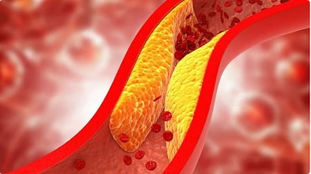 «الخضيري»: 10 نصائح لعلاج ارتفاع الكوليسترول